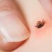 Lyme Disease Uncovered: Spot the Signs, Seek the Right Care